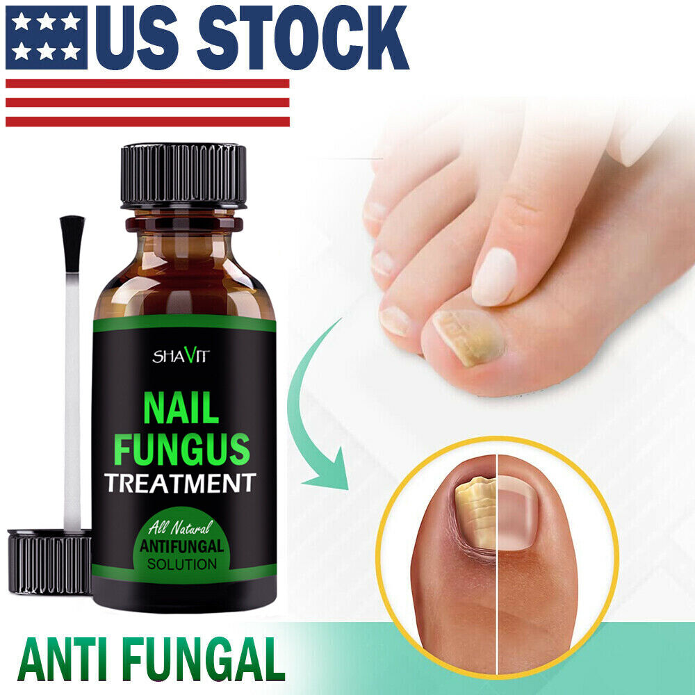 Toenail And Fingernail Fungus Treatment Extra Strength Antifungal Athletes Foot - Premium Nail Care from erDouckan - Just $20! Shop now at Concordia Style Boutique