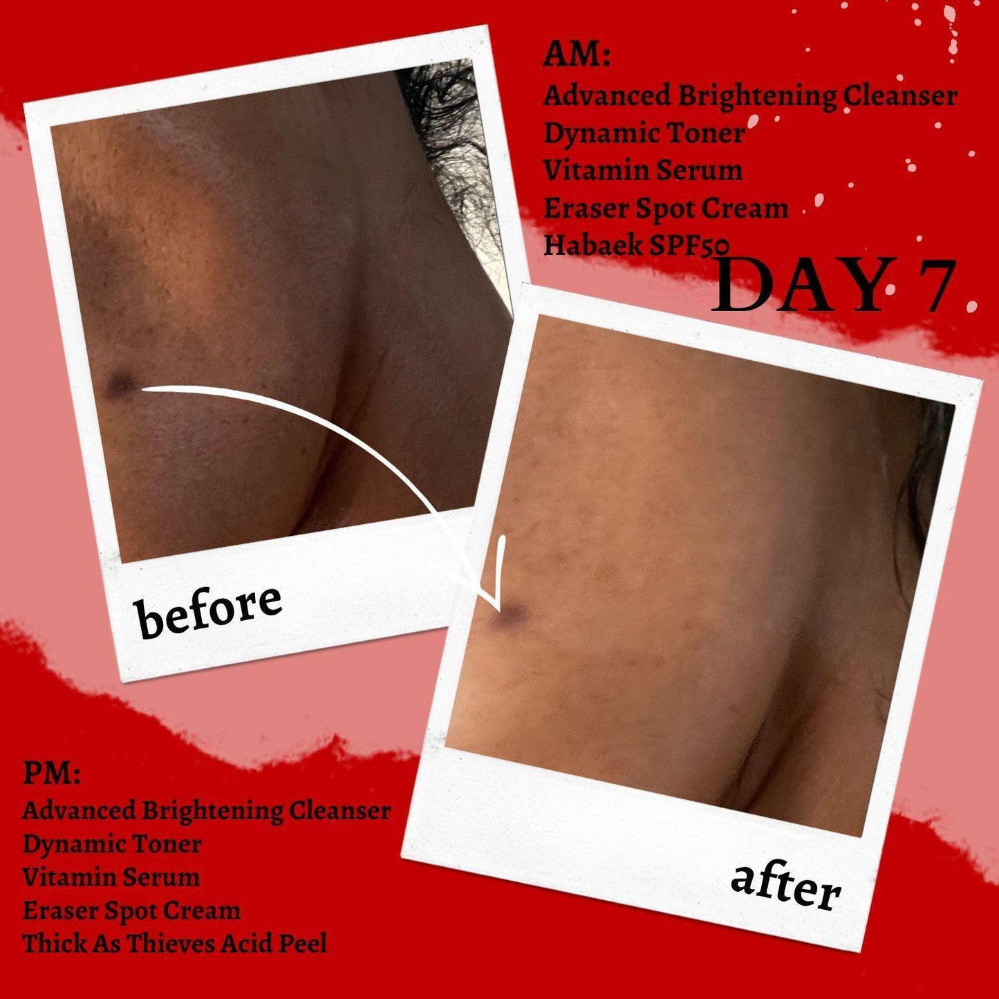 The Eraser Spot Cream | Dark Spot Remover - Concordia Style Boutique