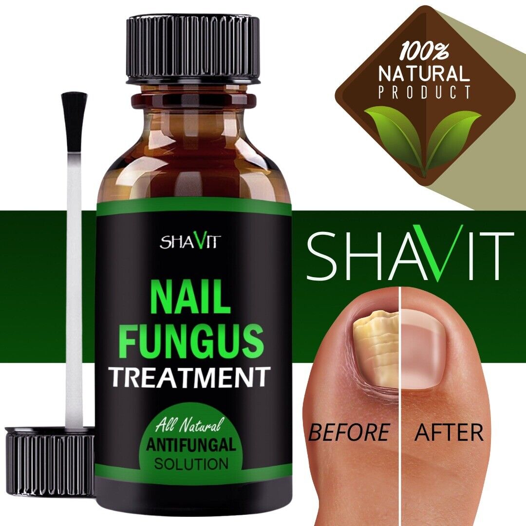 Toenail And Fingernail Fungus Treatment Extra Strength Antifungal Athletes Foot - Premium Nail Care from erDouckan - Just $20! Shop now at Concordia Style Boutique