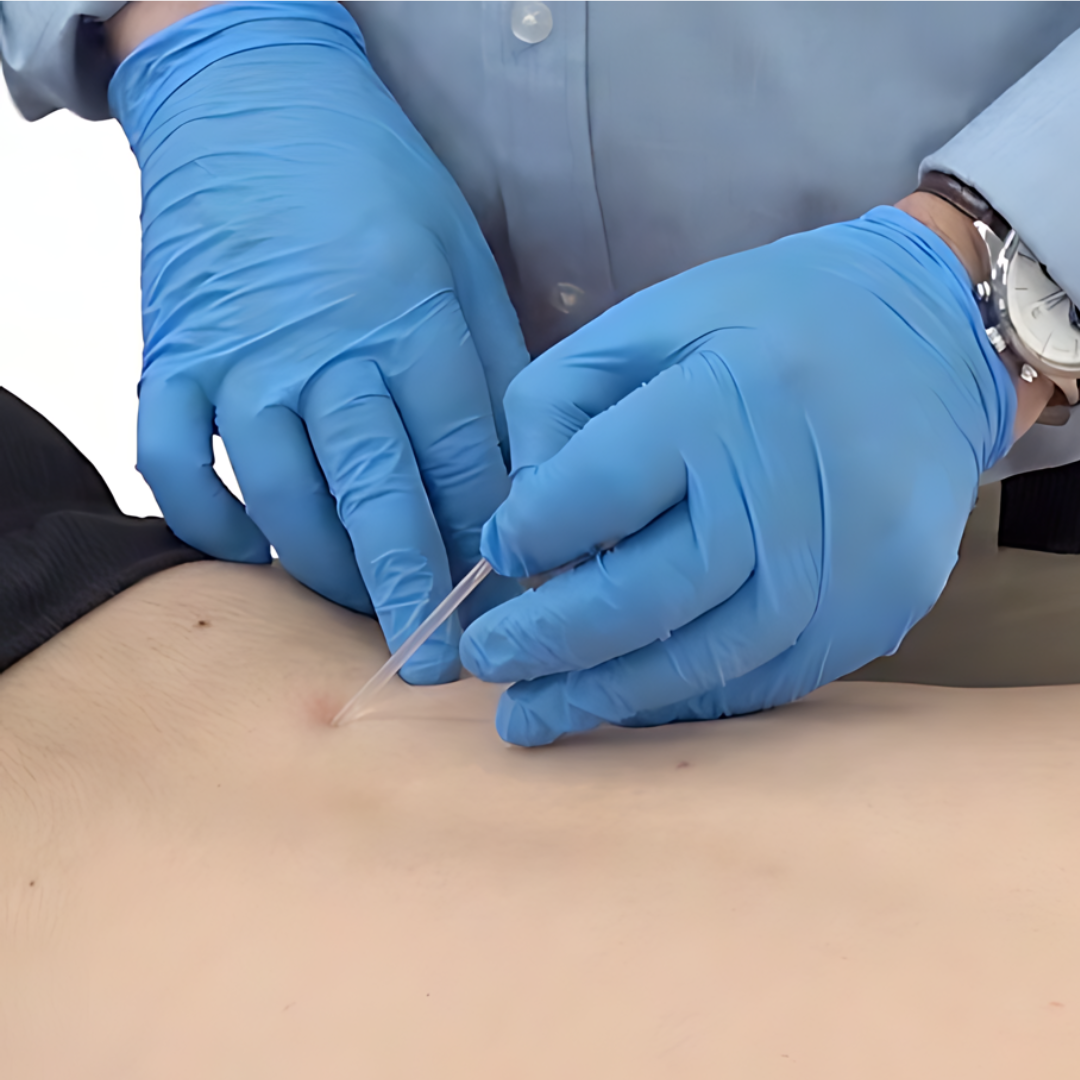 Trigger Point Dry Needling - IMS (18 hrs) - Concordia Style Boutique