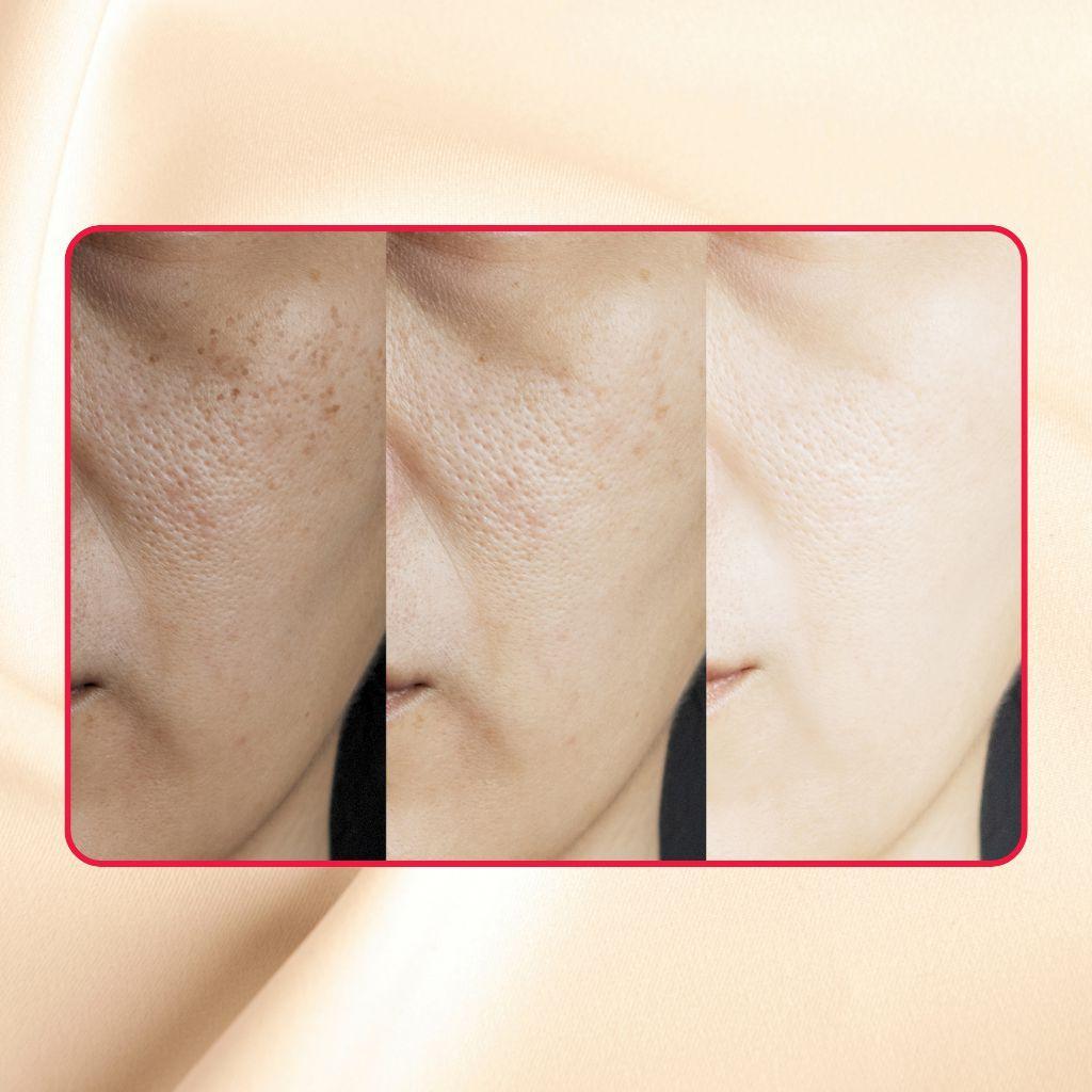 Thick As Thieves Pure Glycolic Acid Lactic Acid Extreme Gel Peel - Concordia Style Boutique