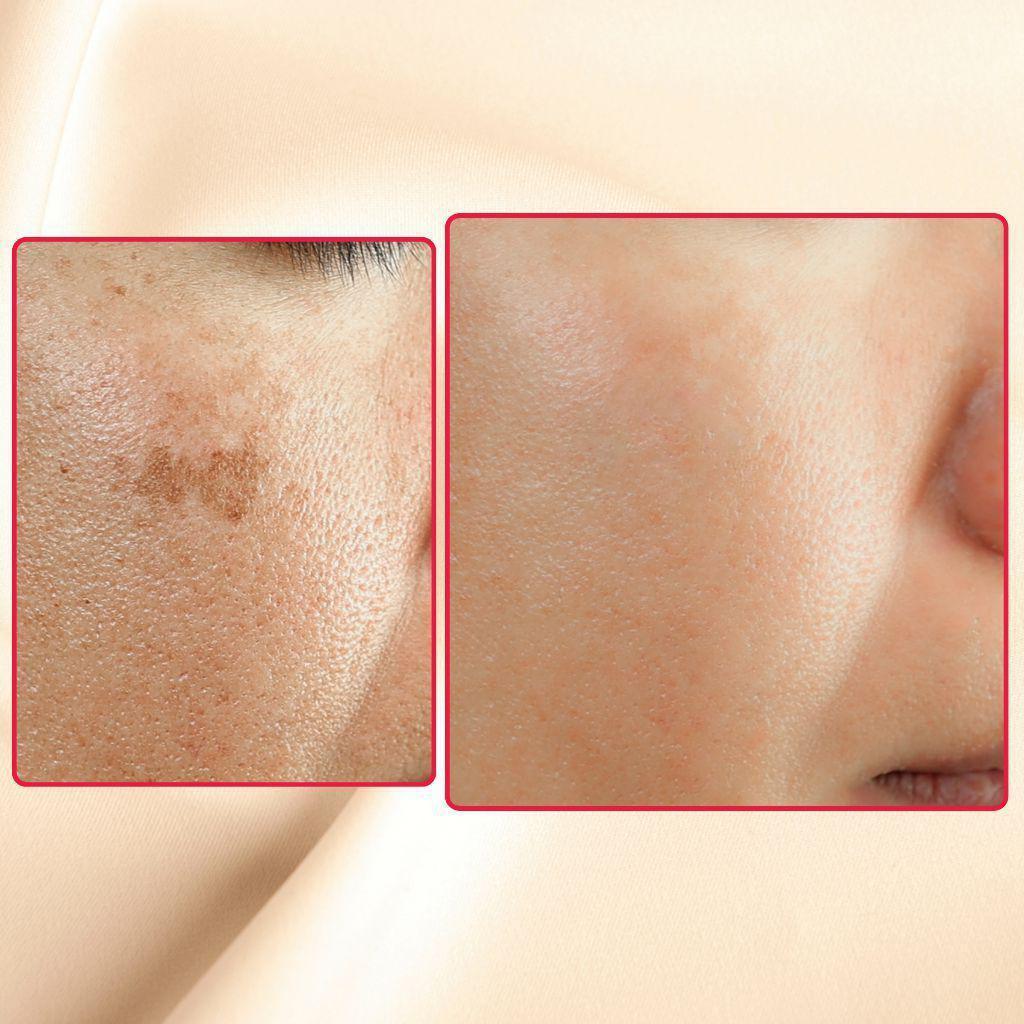 The Eraser Spot Cream | Dark Spot Remover - Concordia Style Boutique
