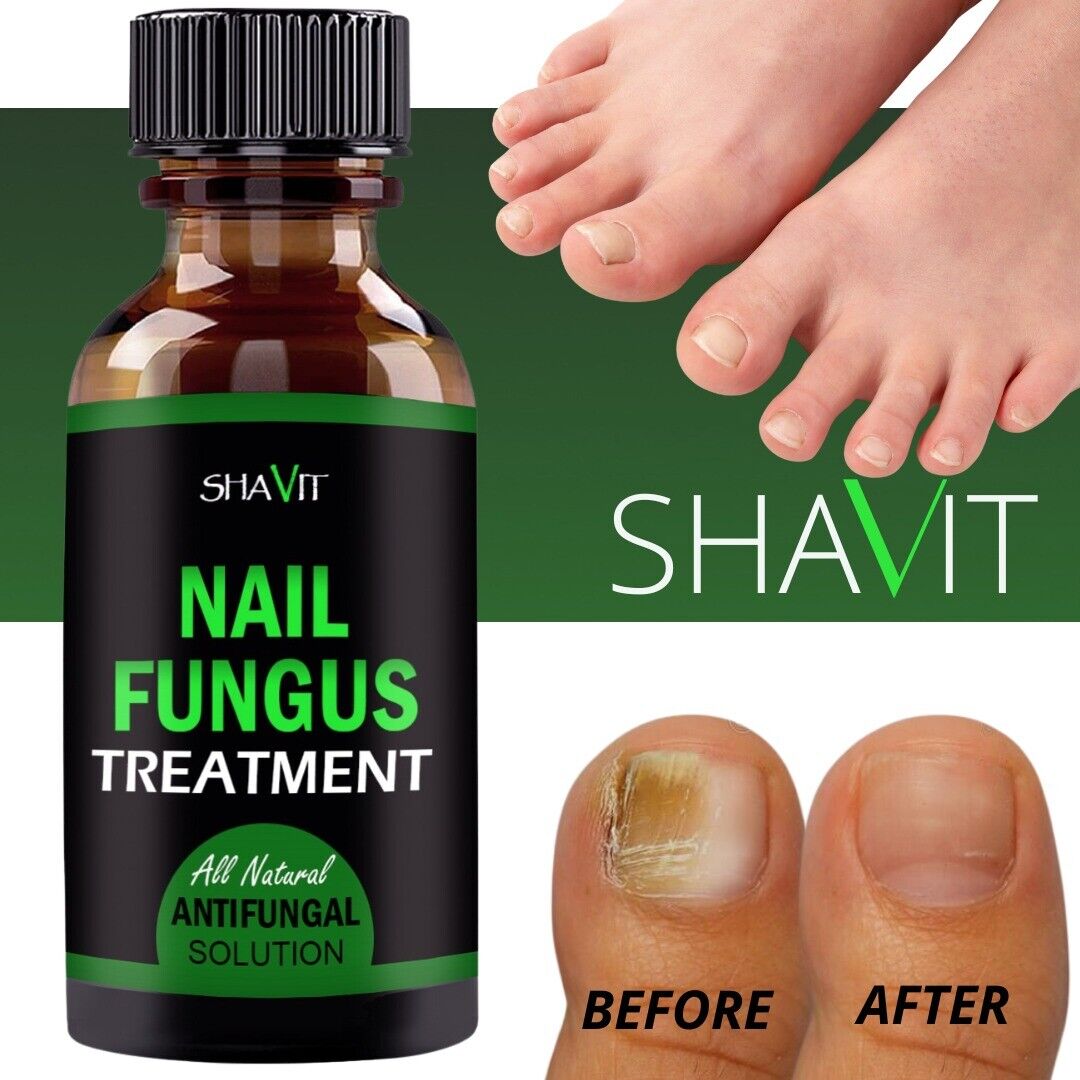 Toenail And Fingernail Fungus Treatment Extra Strength Antifungal Athletes Foot - Premium Nail Care from erDouckan - Just $20! Shop now at Concordia Style Boutique