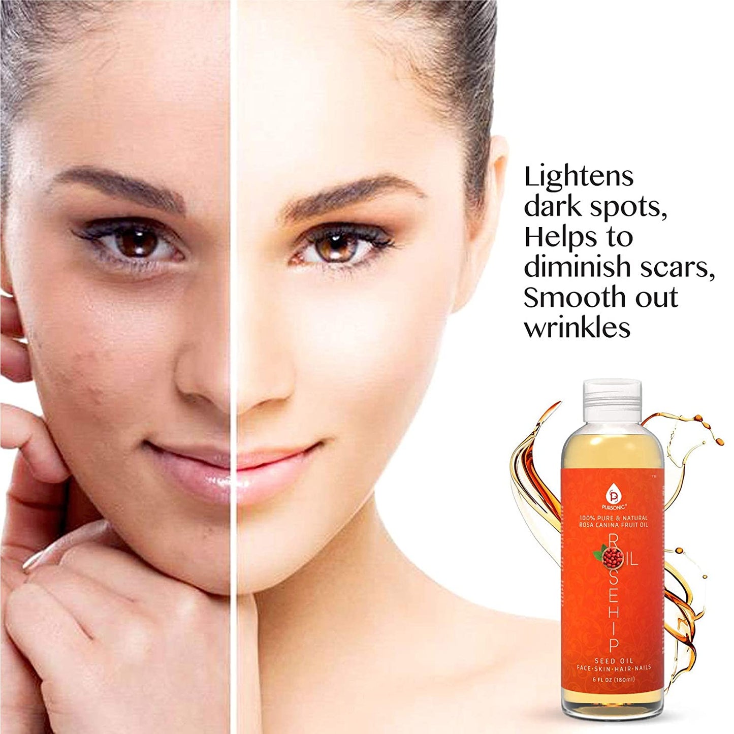 100% Pure & Natural Cold Pressed Premium Rosehip Seed Oil 6 Oz - Concordia Style Boutique