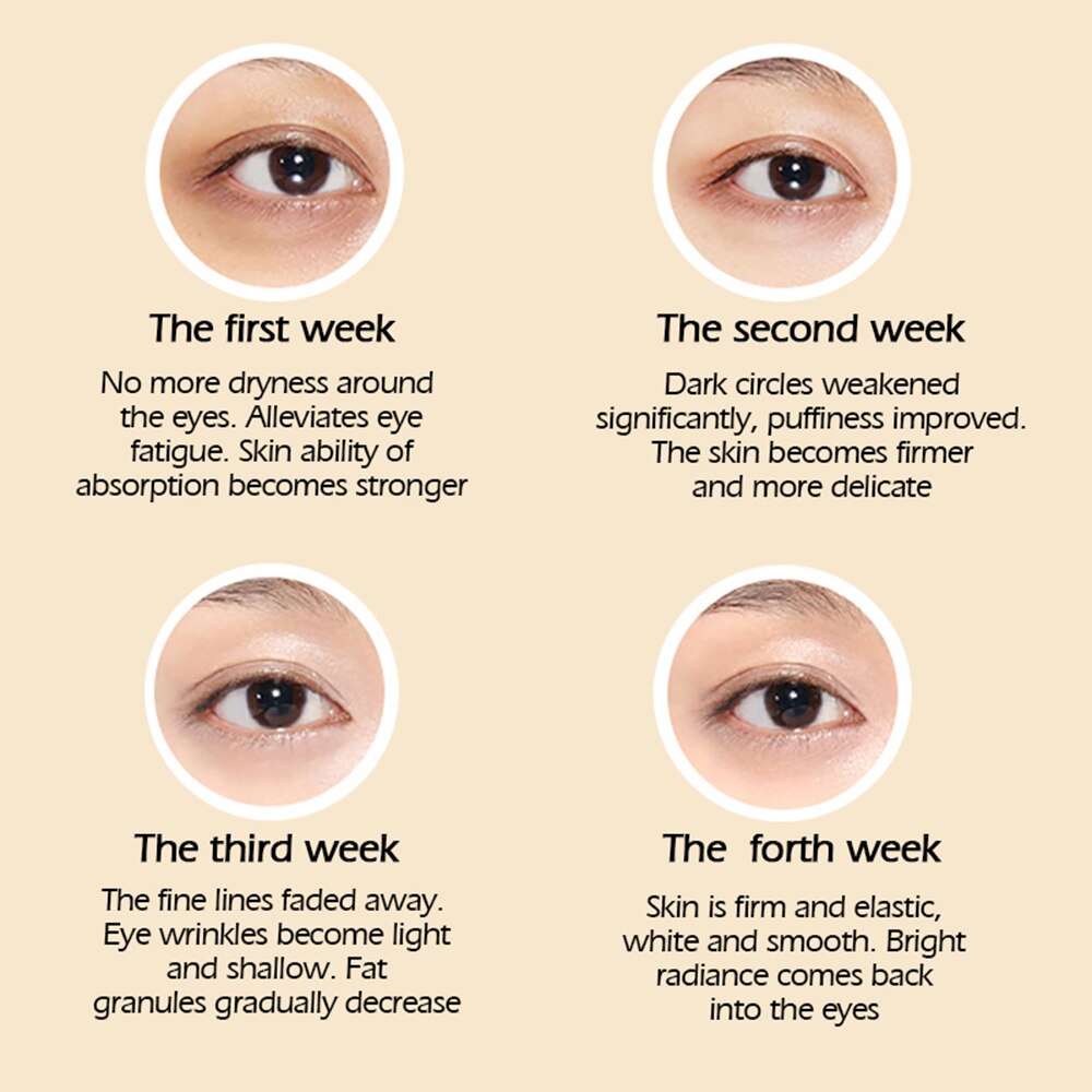 Magic Eye Cream - Removal of Dark Circles - Anti-Wrinkles and Eye Bags - Repair Crocodile Eyes - Serum Peptide - Collagen Serum (1 Piece)) - Premium Eye Cream from Concordia Style Boutique - Just $12.02! Shop now at Concordia Style Boutique
