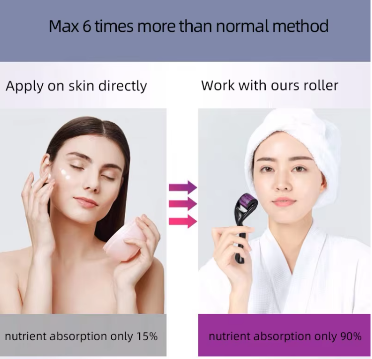 540 Micro Needle Derma Roller for Skin - Premium derma roller from Concordia Style Boutique - Just $7.72! Shop now at Concordia Style Boutique