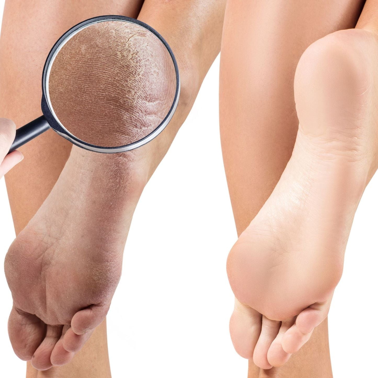 Crocodile Killer Dry Skin Pudding - Unscented (3 sizes)