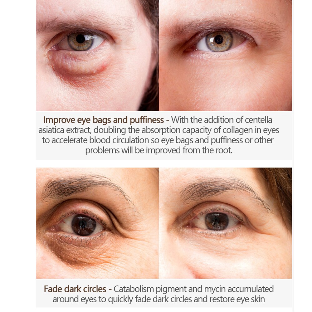 Magic Eye Cream - Removal of Dark Circles - Anti-Wrinkles and Eye Bags - Repair Crocodile Eyes - Serum Peptide - Collagen Serum (1 Piece)) - Premium Eye Cream from Concordia Style Boutique - Just $12.02! Shop now at Concordia Style Boutique