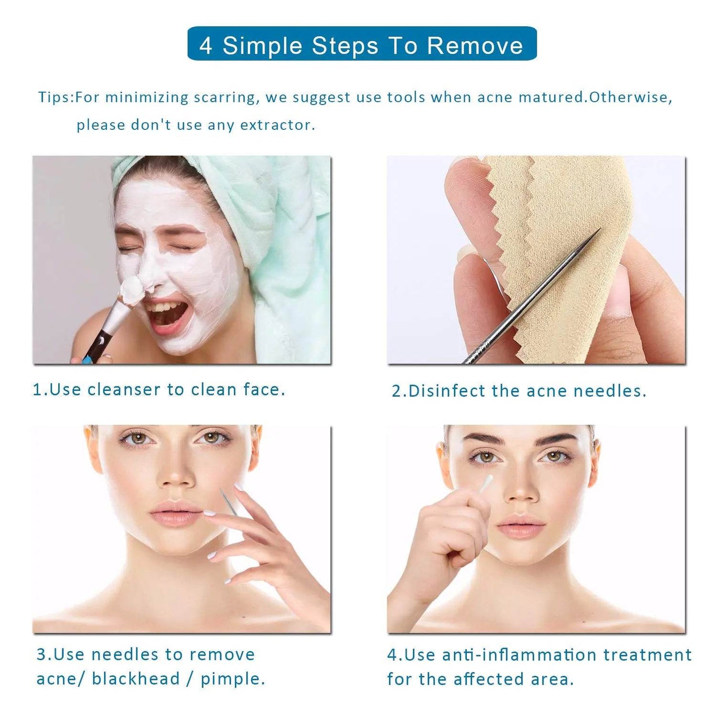 5 PCS Blackhead Remover Comedone Extractor, Curved Blackhead Tweezers Kit, Professional Stainless Pimple Acne Blemish Removal Tools Kit - Concordia Style Boutique