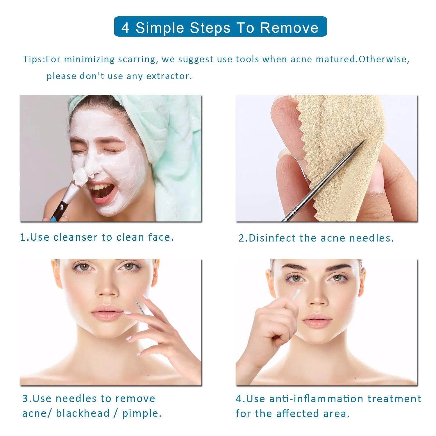 5 PCS Blackhead Remover Comedone Extractor, Curved Blackhead Tweezers Kit, Professional Stainless Pimple Acne Blemish Removal Tools Kit - Concordia Style Boutique