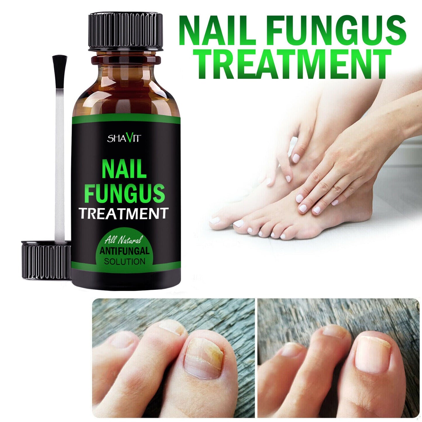 Toenail And Fingernail Fungus Treatment Extra Strength Antifungal Athletes Foot - Premium Nail Care from erDouckan - Just $20! Shop now at Concordia Style Boutique