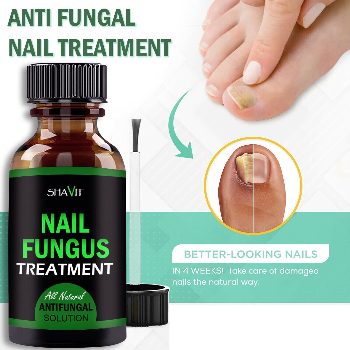 Toenail And Fingernail Fungus Treatment Extra Strength Antifungal Athletes Foot - Premium Nail Care from erDouckan - Just $20! Shop now at Concordia Style Boutique