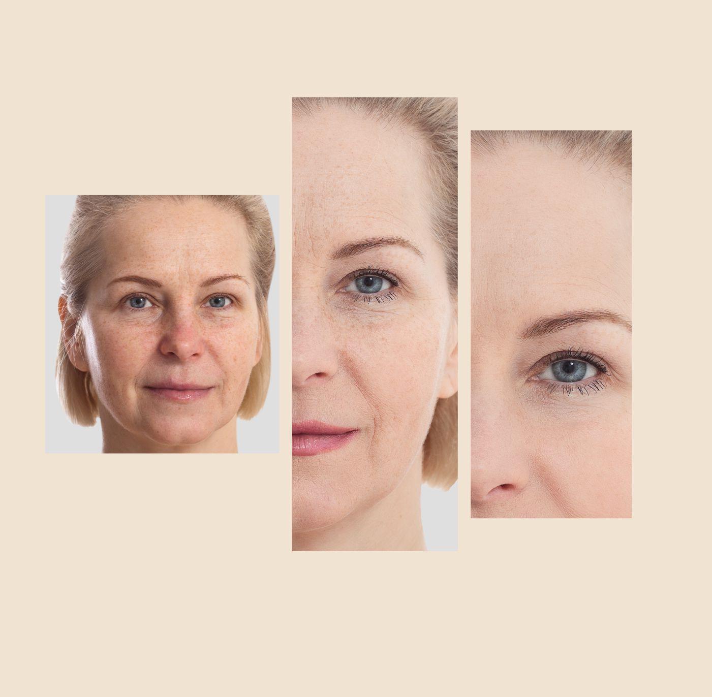 The Eraser Spot Cream | Dark Spot Remover - Concordia Style Boutique