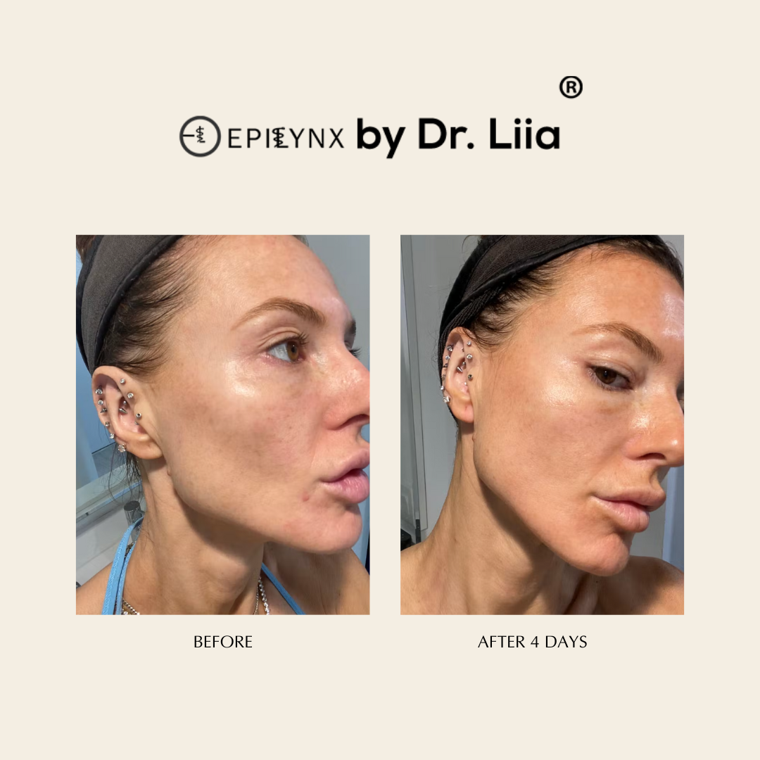 Illuminating Serum with Lactic and Salicylic Acid - Gentle - Concordia Style Boutique