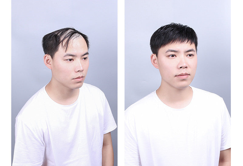 Men's Hair Replacement Forehead Bald Flip Cover - Concordia Style Boutique