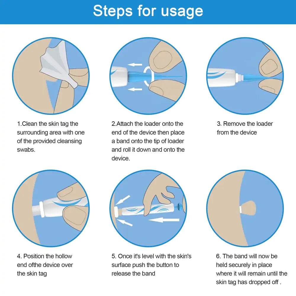 Painless Wart Removal Kit - Concordia Style Boutique