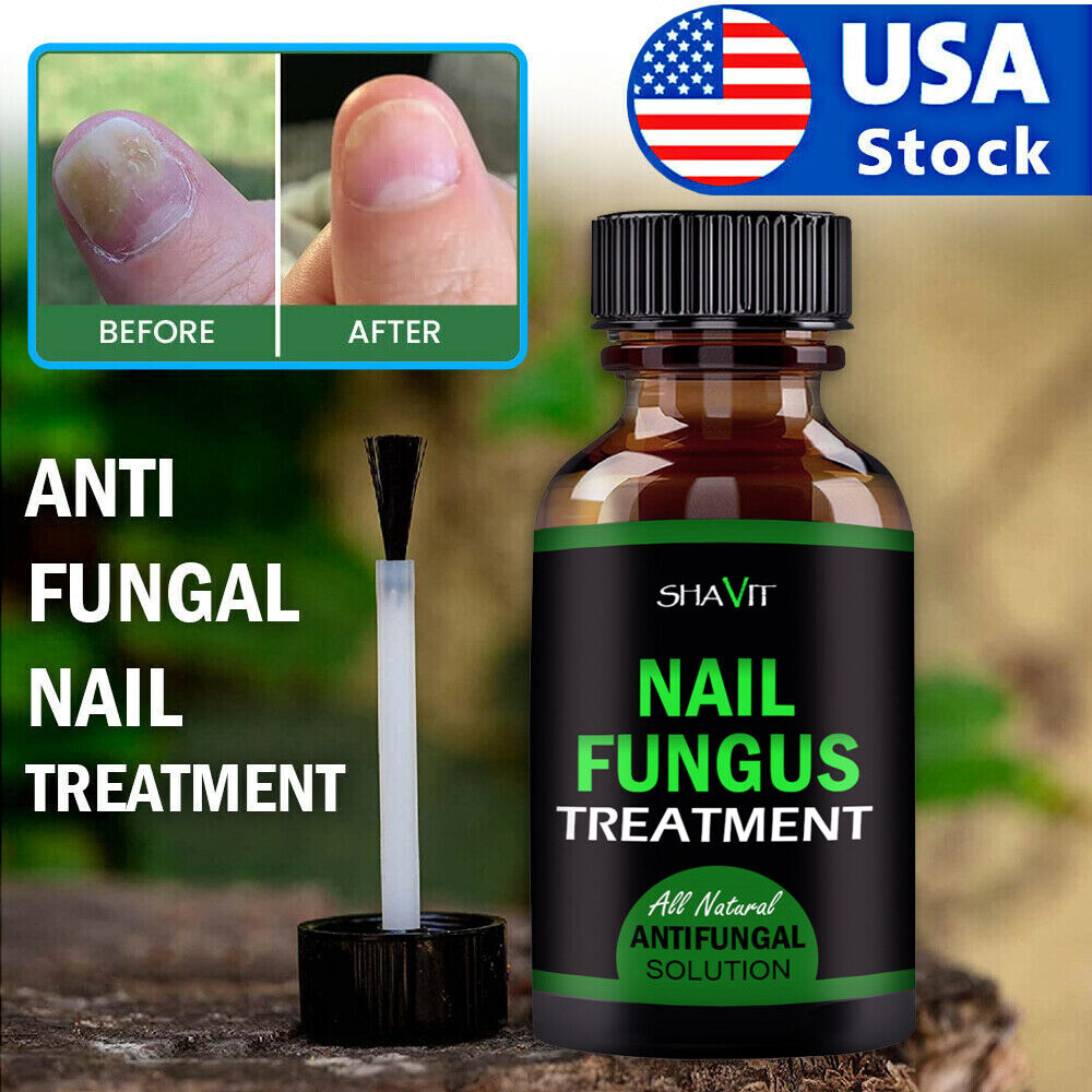 Toenail And Fingernail Fungus Treatment Extra Strength Antifungal Athletes Foot - Premium Nail Care from erDouckan - Just $20! Shop now at Concordia Style Boutique