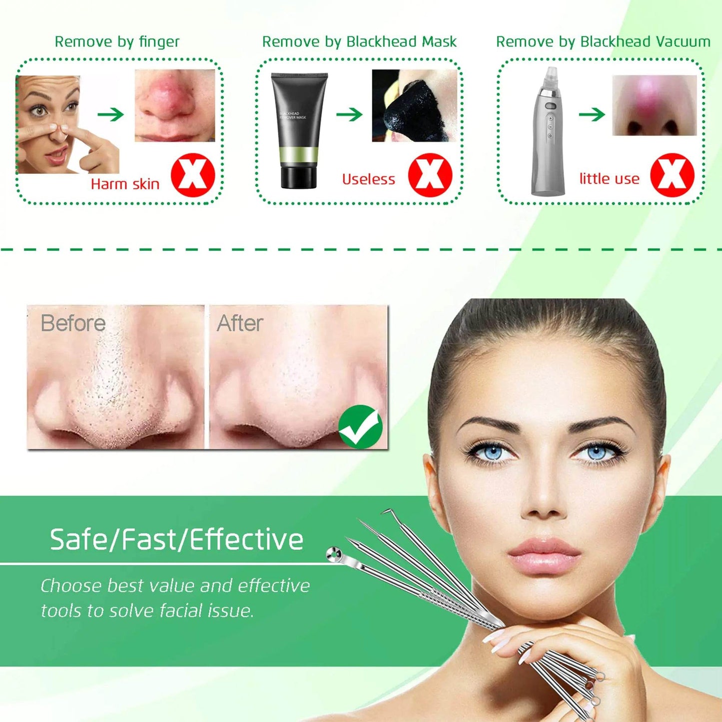 5 PCS Blackhead Remover Comedone Extractor, Curved Blackhead Tweezers Kit, Professional Stainless Pimple Acne Blemish Removal Tools Kit - Concordia Style Boutique