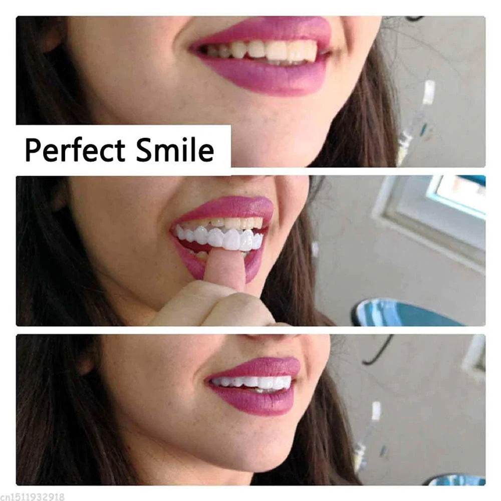 Instant Perfect Smile Dental Veneers - Concordia Style Boutique