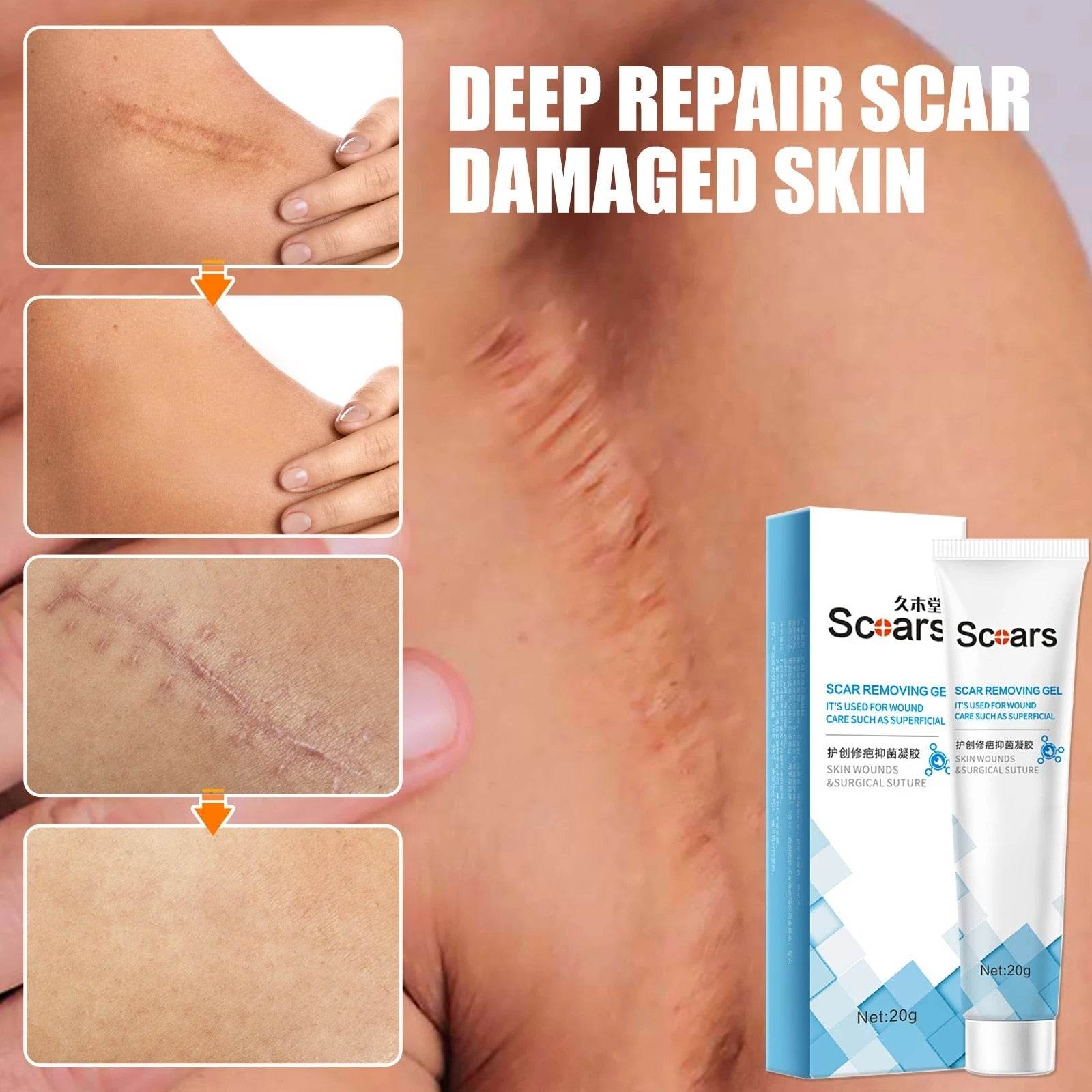 New Herbal Scar Repair Cream - Concordia Style Boutique