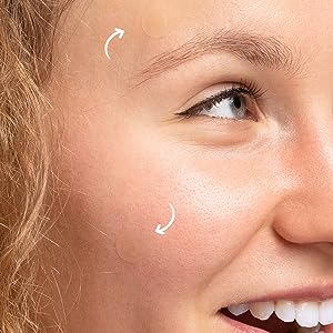 Mighty Patch™ Invisible+ patch from Hero Cosmetics - Daytime Hydrocolloid Acne Pimple Patches for Covering Zits and Blemishes, Ultra Thin Spot Stickers for Face and Skin, Vegan-friendly (39 Count) - Premium Hydrocolloid Acne Pimple Patches from Concordia Style Boutique - Just $20.86! Shop now at Concordia Style Boutique