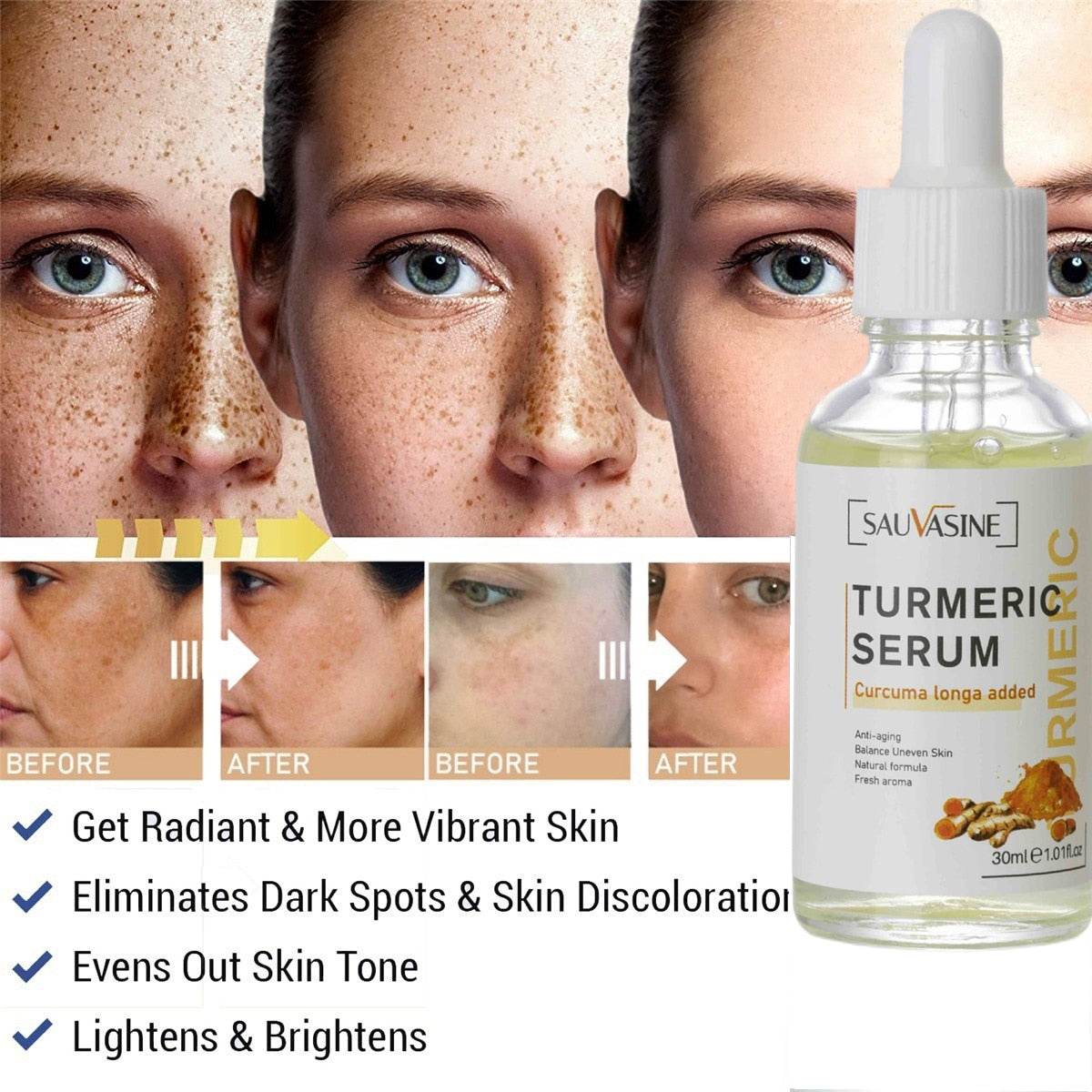 Turmeric Face Whitening Serum - Concordia Style Boutique