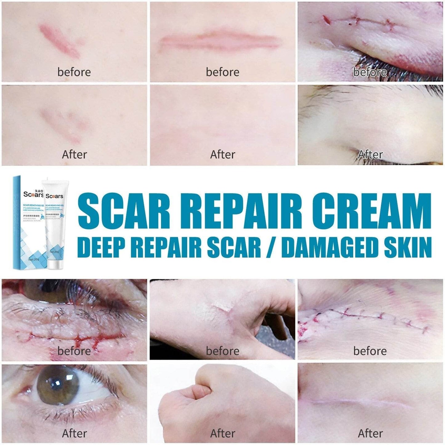 New Herbal Scar Repair Cream - Concordia Style Boutique