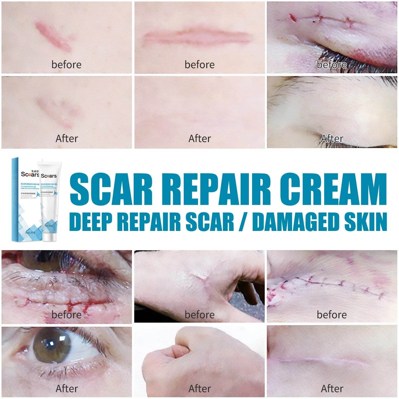 New Herbal Scar Repair Cream - Concordia Style Boutique