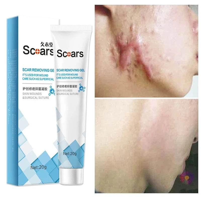 New Herbal Scar Repair Cream - Concordia Style Boutique
