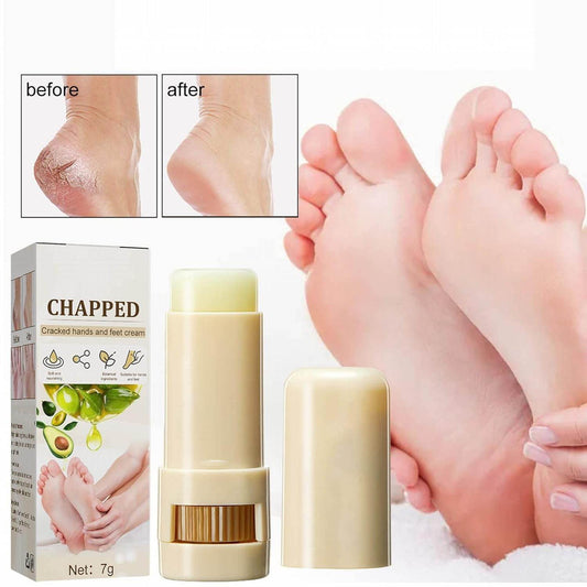 Shea Butter Foot Cracked Cream Moisturizing Nourishing Hand and Foot Care Treatment Stick, Natural Mild Moisturizer Suitable for Rough Dry Chapped Feet - Concordia Style Boutique