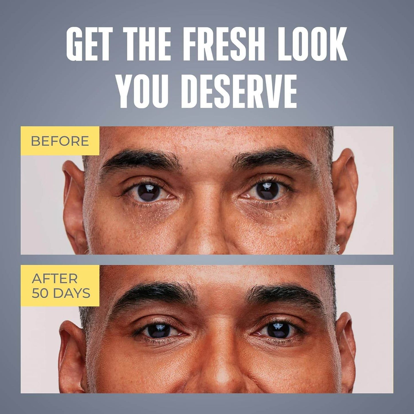 Men's Eye Cream - Eye Treatment Balm for Dark Circles and Puffiness - Caffeine Eye Cream - Niacinamide (Vitamin B3), Collagen, Peptides - Under Eye Brightener - Eye Care - Concordia Style Boutique