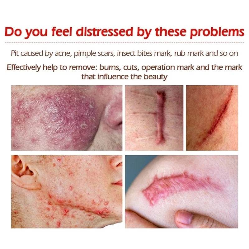 New Herbal Scar Repair Cream - Concordia Style Boutique