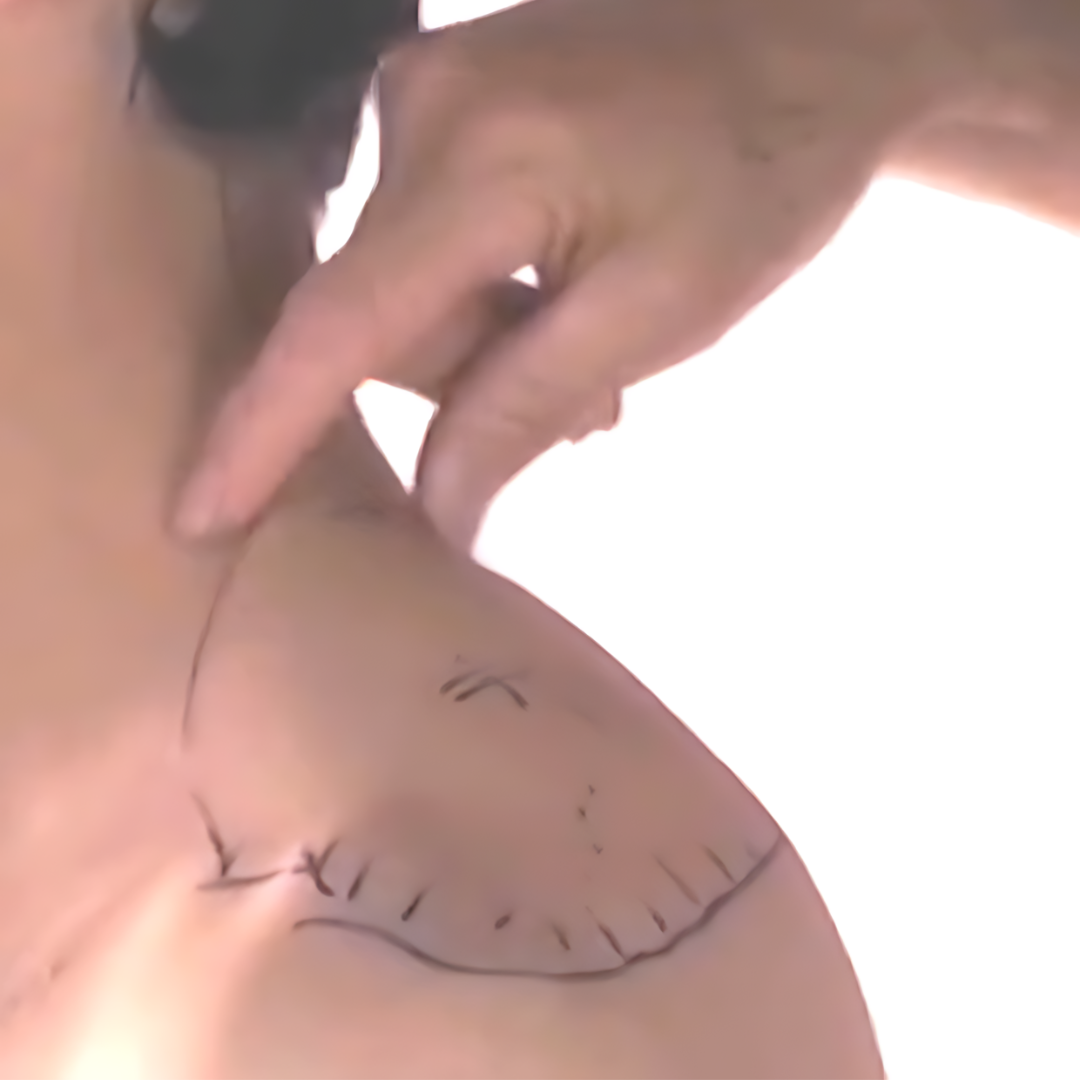 Tension Headache and Trigger Points (4 hrs) - Concordia Style Boutique