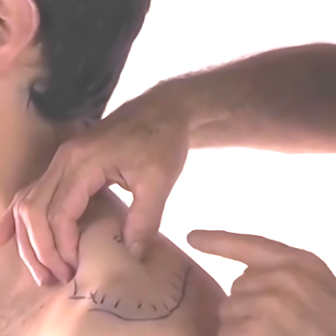 Tension Headache and Trigger Points (4 hrs) - Concordia Style Boutique