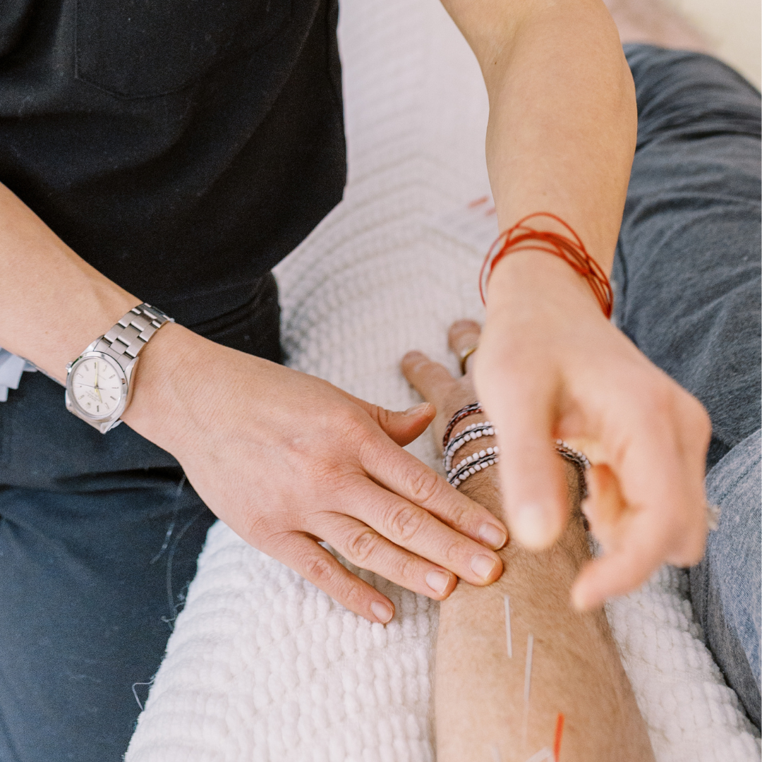 Foundation in Acupuncture (Level 1) - Concordia Style Boutique