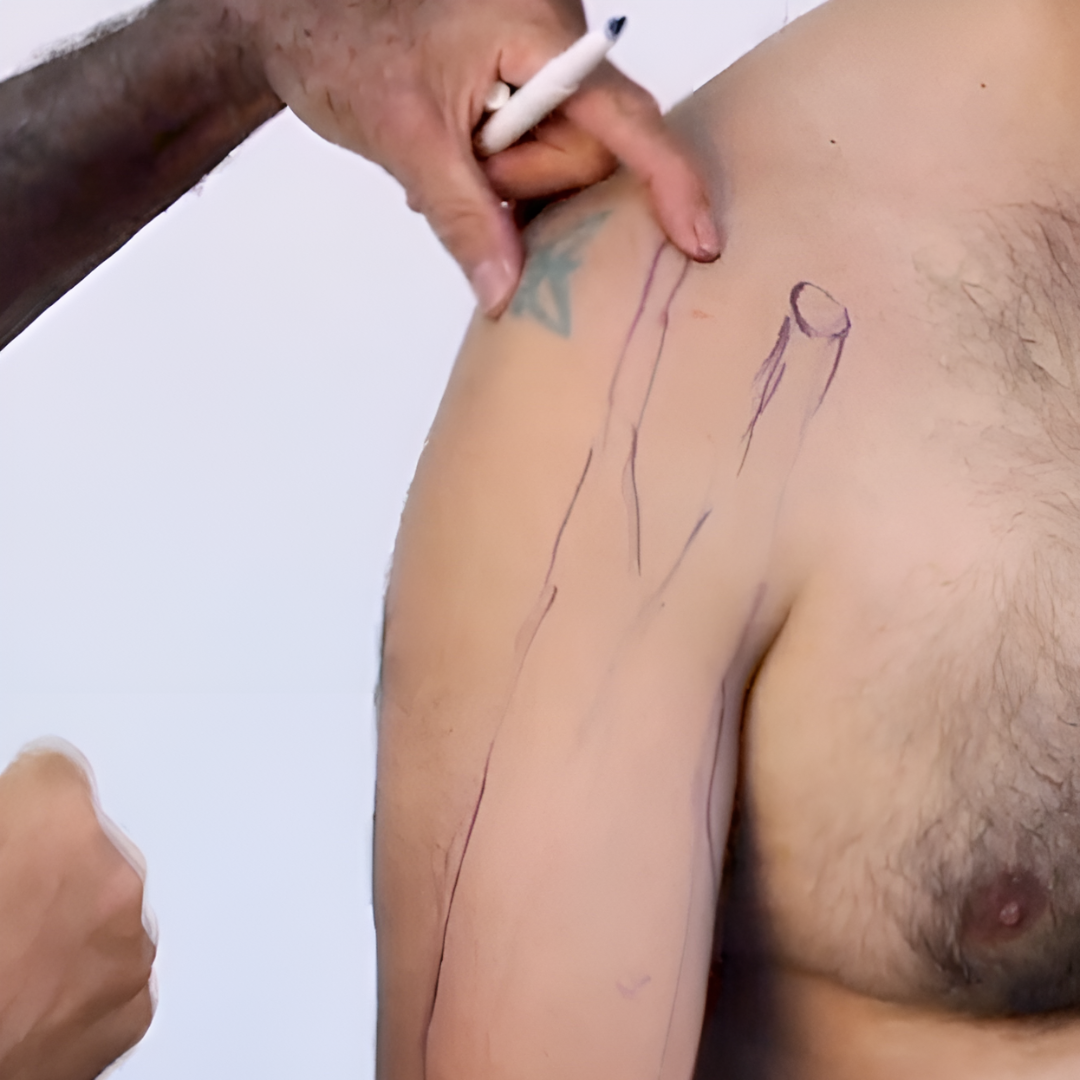 NAT Treating Elbow and Wrist Injuries (2.5 hrs) - Concordia Style Boutique