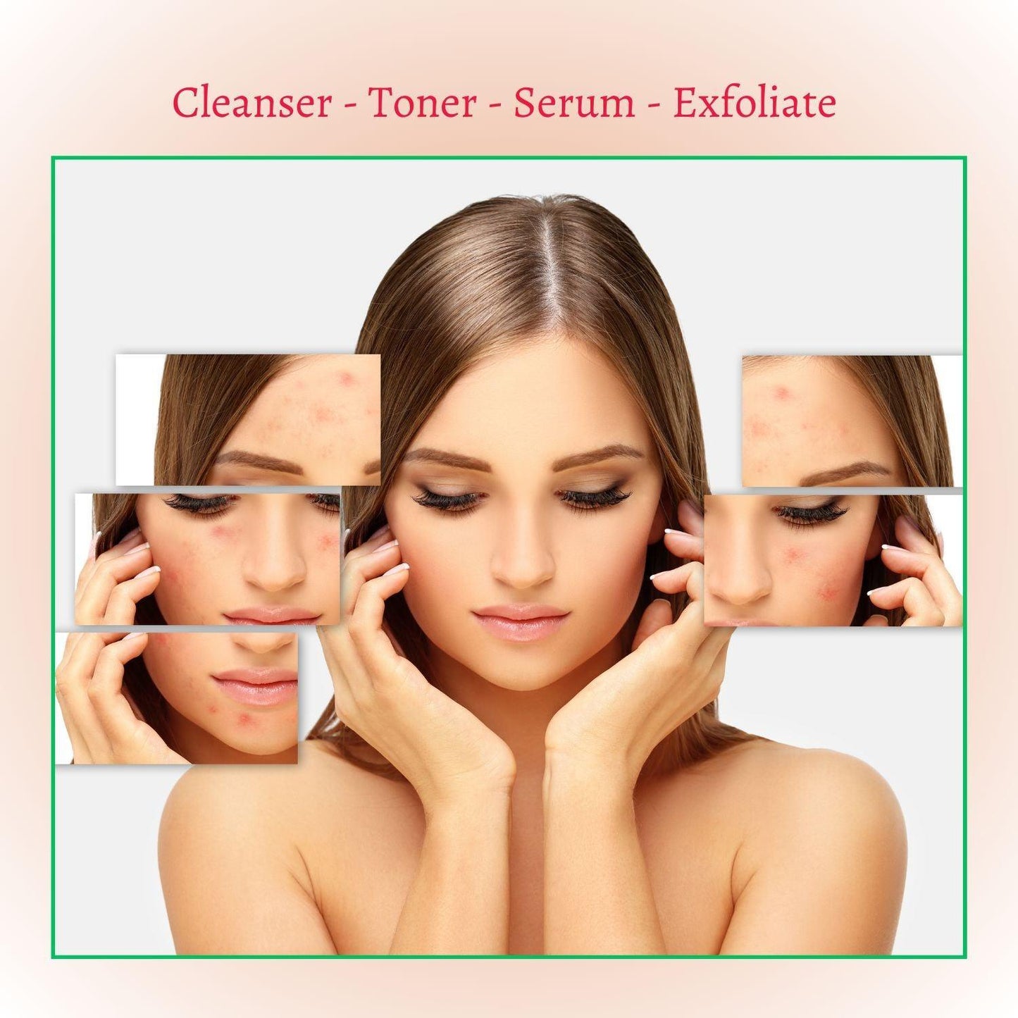 Perfect Trifecta Acne Peel - Concordia Style Boutique