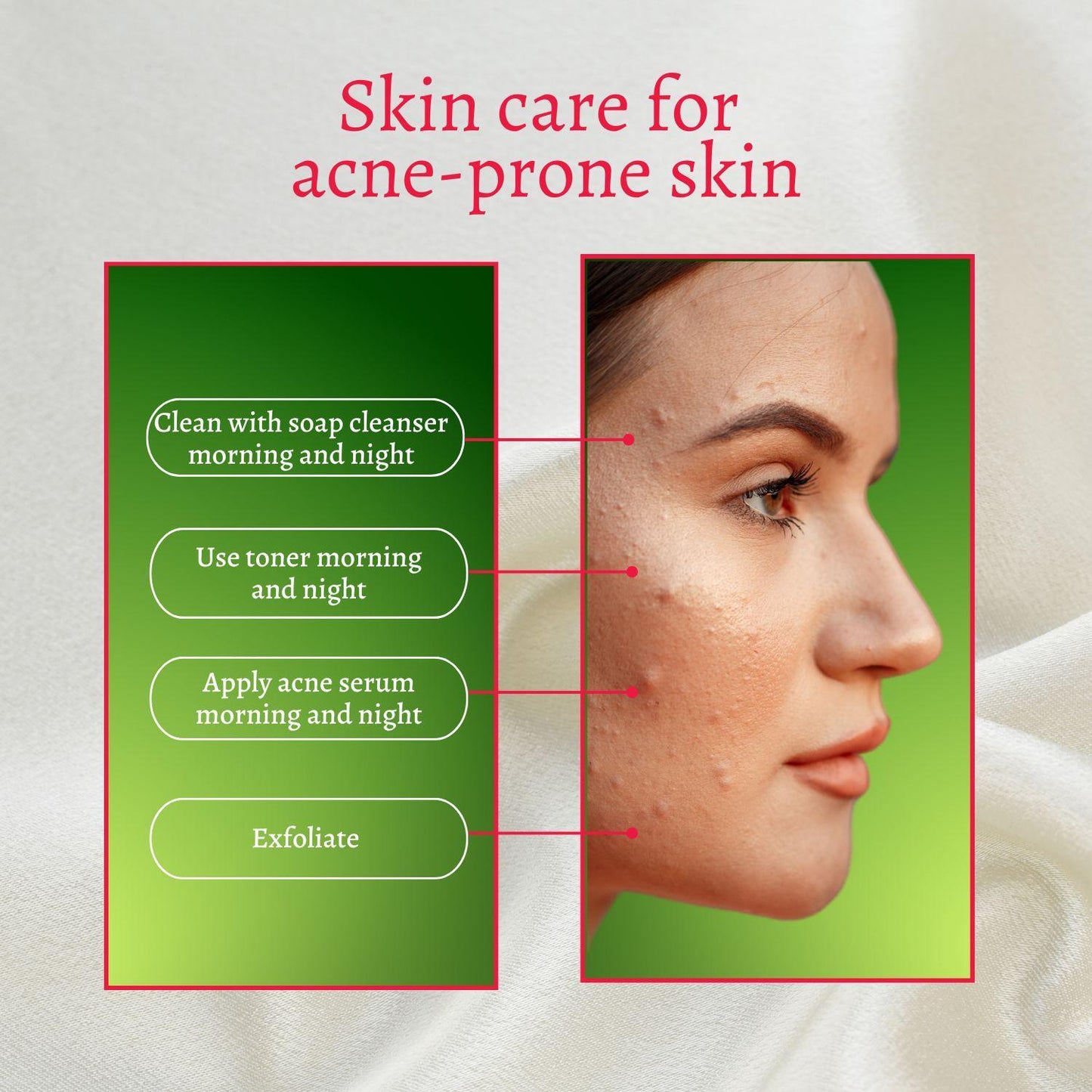 Perfect Trifecta Acne Peel - Concordia Style Boutique