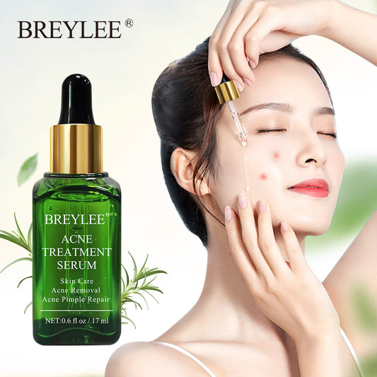 BREYLEE Acne Treatment Face Serum Mask - Anti Acne Pimple Scar Remover - Premium Face Serum Mask from Concordia Style Boutique - Just $14.82! Shop now at Concordia Style Boutique
