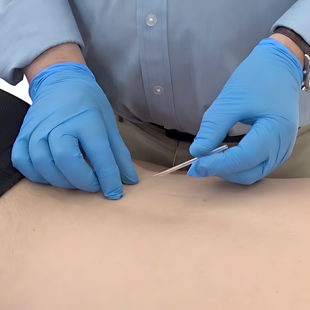 Trigger Point Dry Needling - IMS (18 hrs) - Concordia Style Boutique