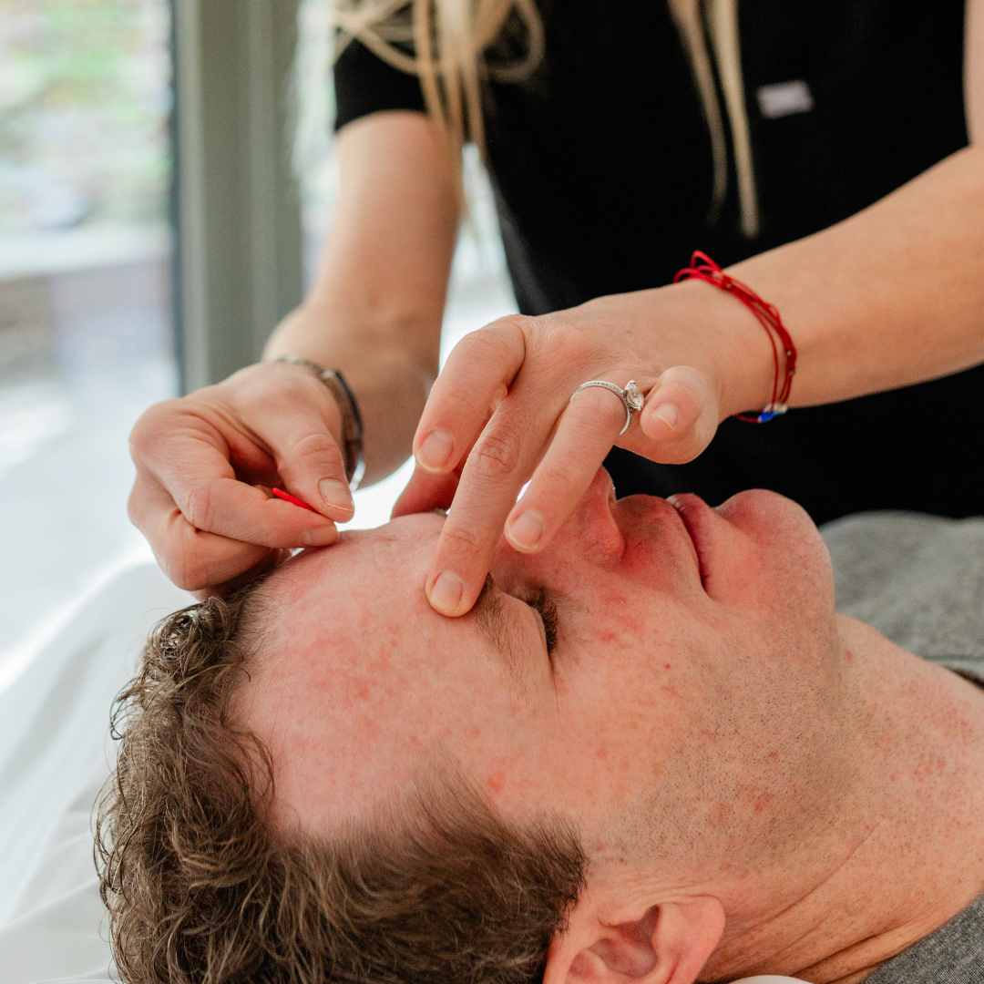 Foundation in Acupuncture (Level 1) - Concordia Style Boutique