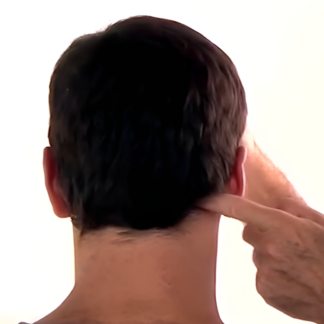 Tension Headache and Trigger Points (4 hrs) - Concordia Style Boutique