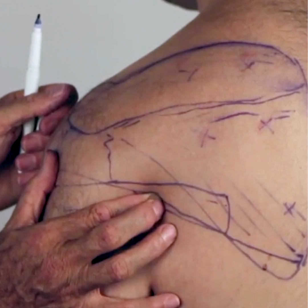 NAT Treating the Rotator Cuff (4 hrs) - Concordia Style Boutique