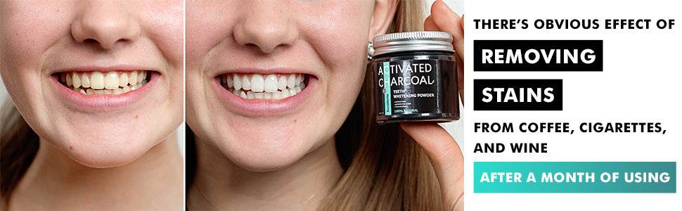 Teeth Whitening Powder - Tooth Whitening 5 in 1 Formula | Blanqueador de Dientes | Charcoal Toothpaste Alternative | Sensitivity Treatments - Concordia Style Boutique