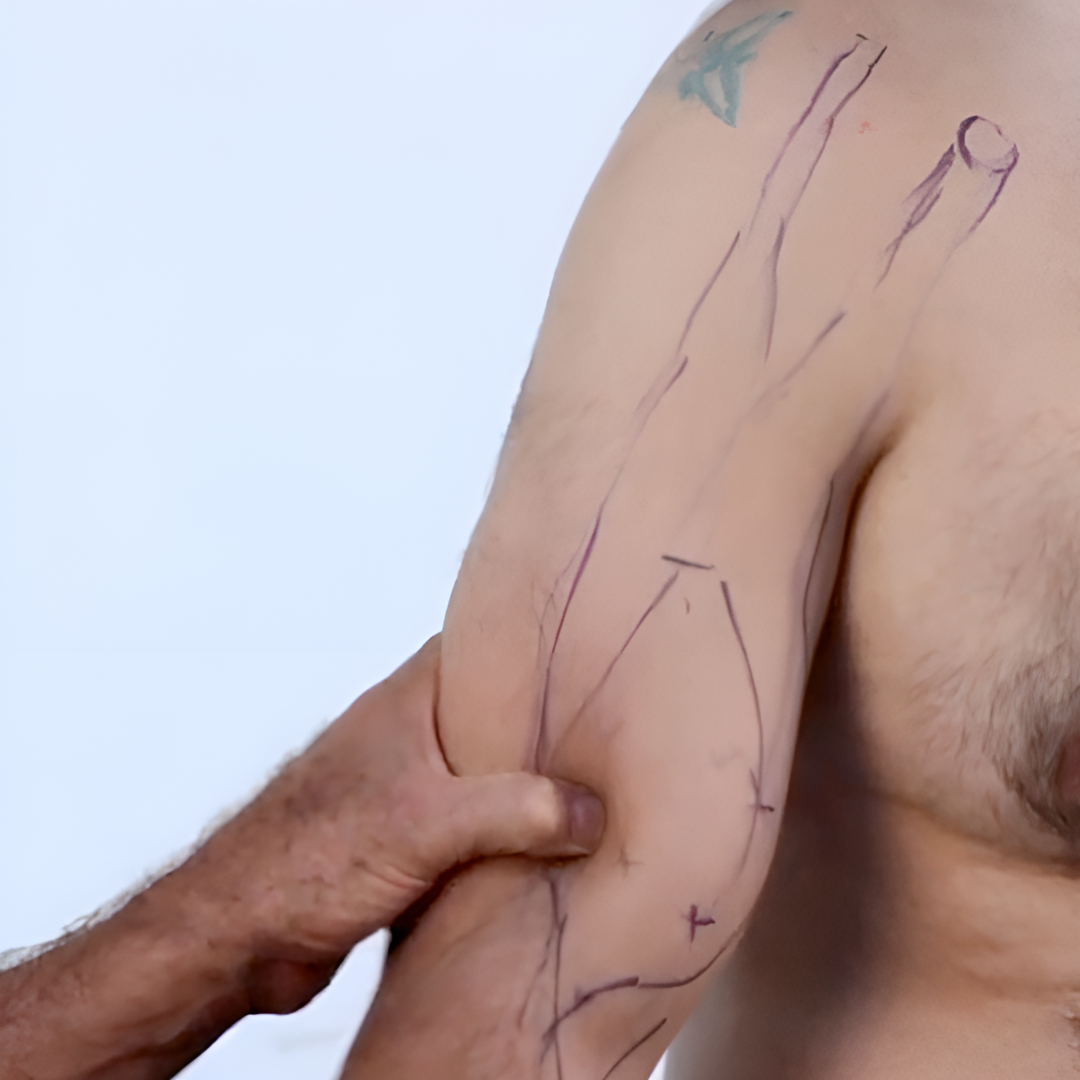 NAT Treating Elbow and Wrist Injuries (2.5 hrs) - Concordia Style Boutique