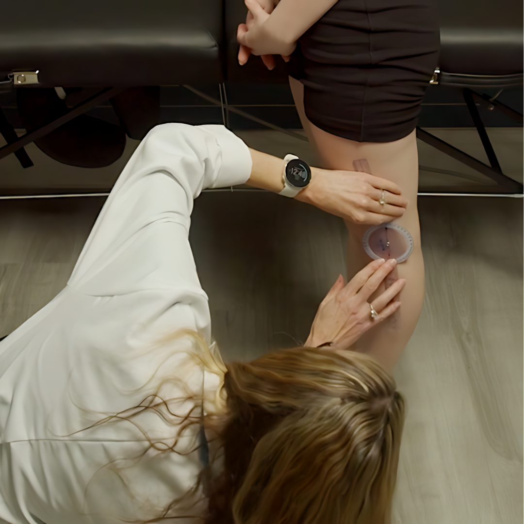 Understanding and Treating Hypermobility (5.5 hrs) - Concordia Style Boutique