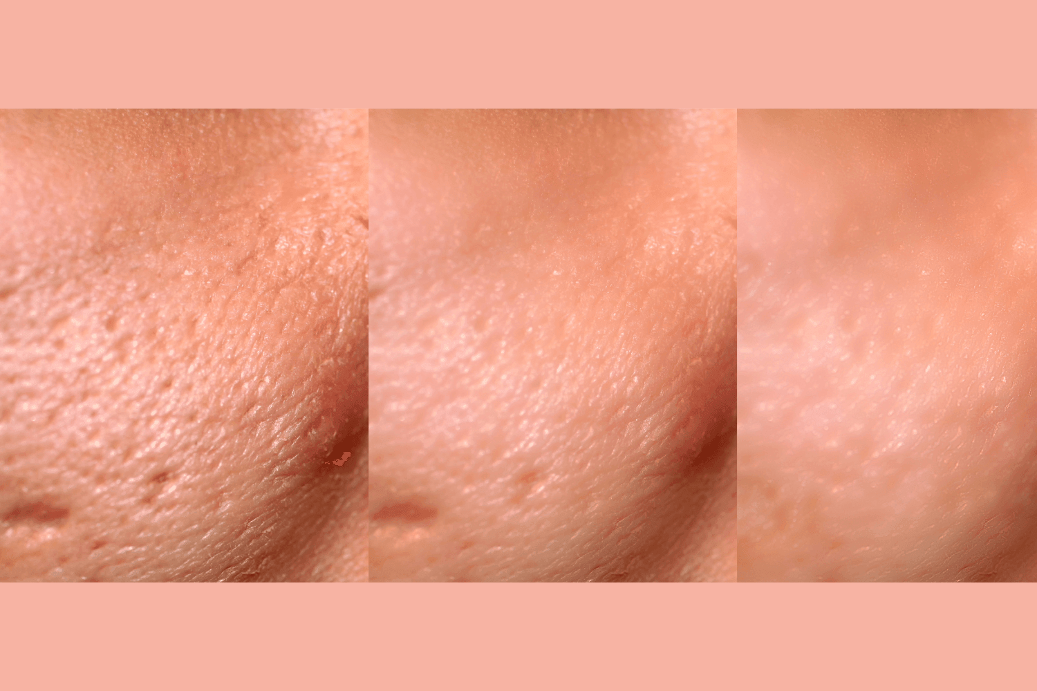 Ultra-Advanced Anti-Aging Daily Resurfacing Pads - Concordia Style Boutique