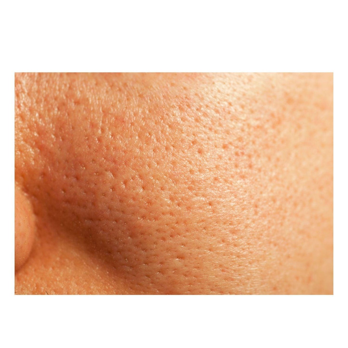 Thick As Thieves Pure Glycolic Acid Lactic Acid Extreme Gel Peel - Concordia Style Boutique