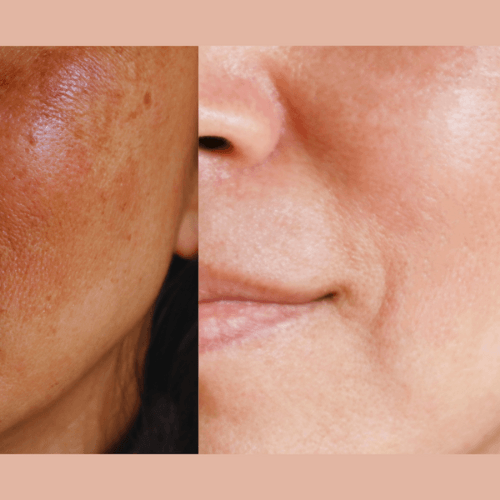 Ultra-Advanced Anti-Aging Daily Resurfacing Pads - Concordia Style Boutique