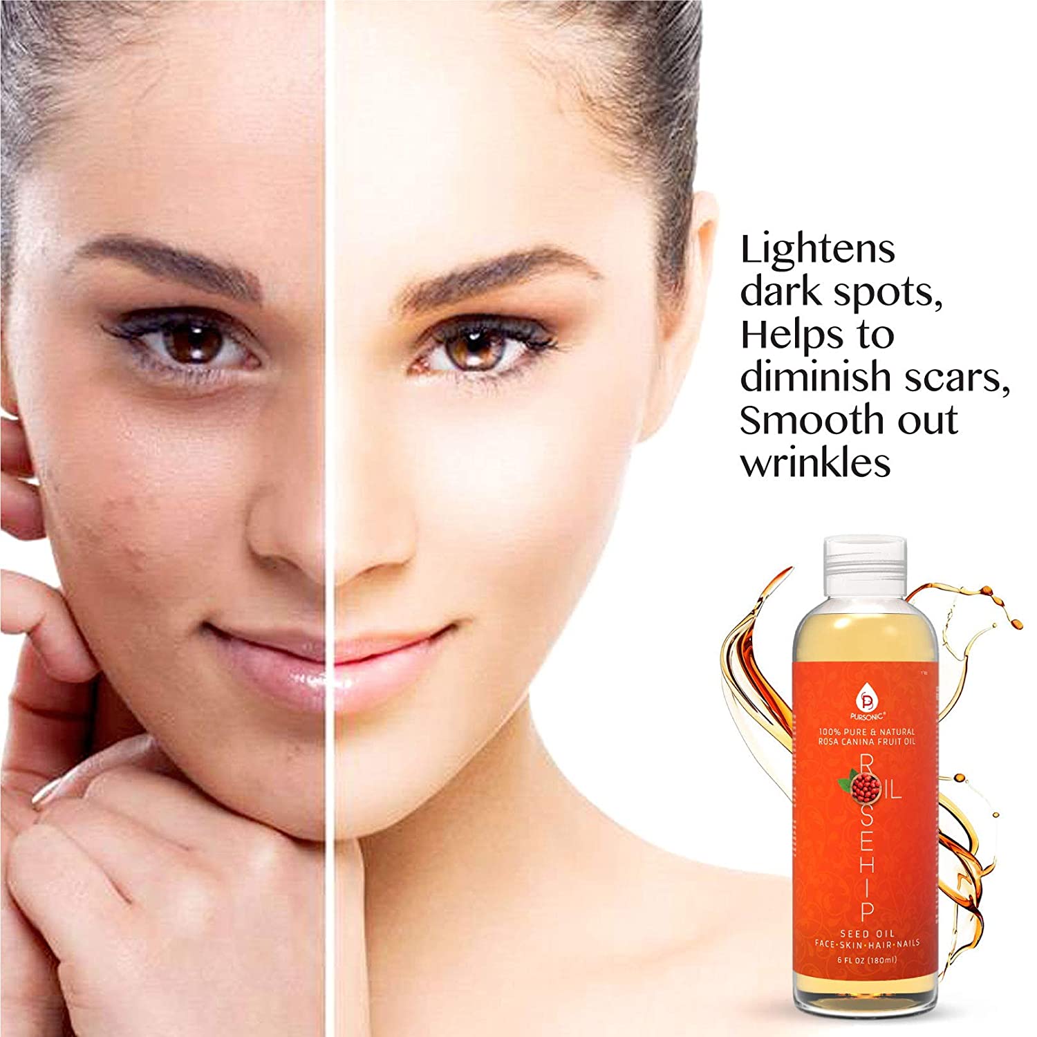 100% Pure & Natural Cold Pressed Premium Rosehip Seed Oil 6 Oz - Concordia Style Boutique